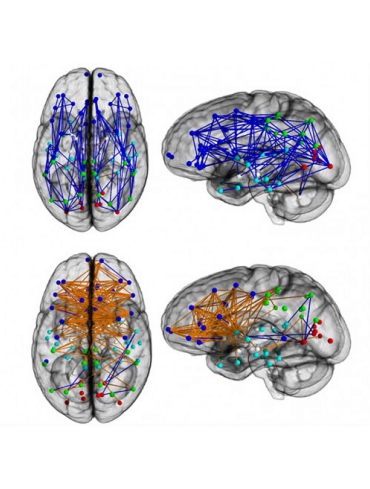 brainconnect-difference-500x489.jpg